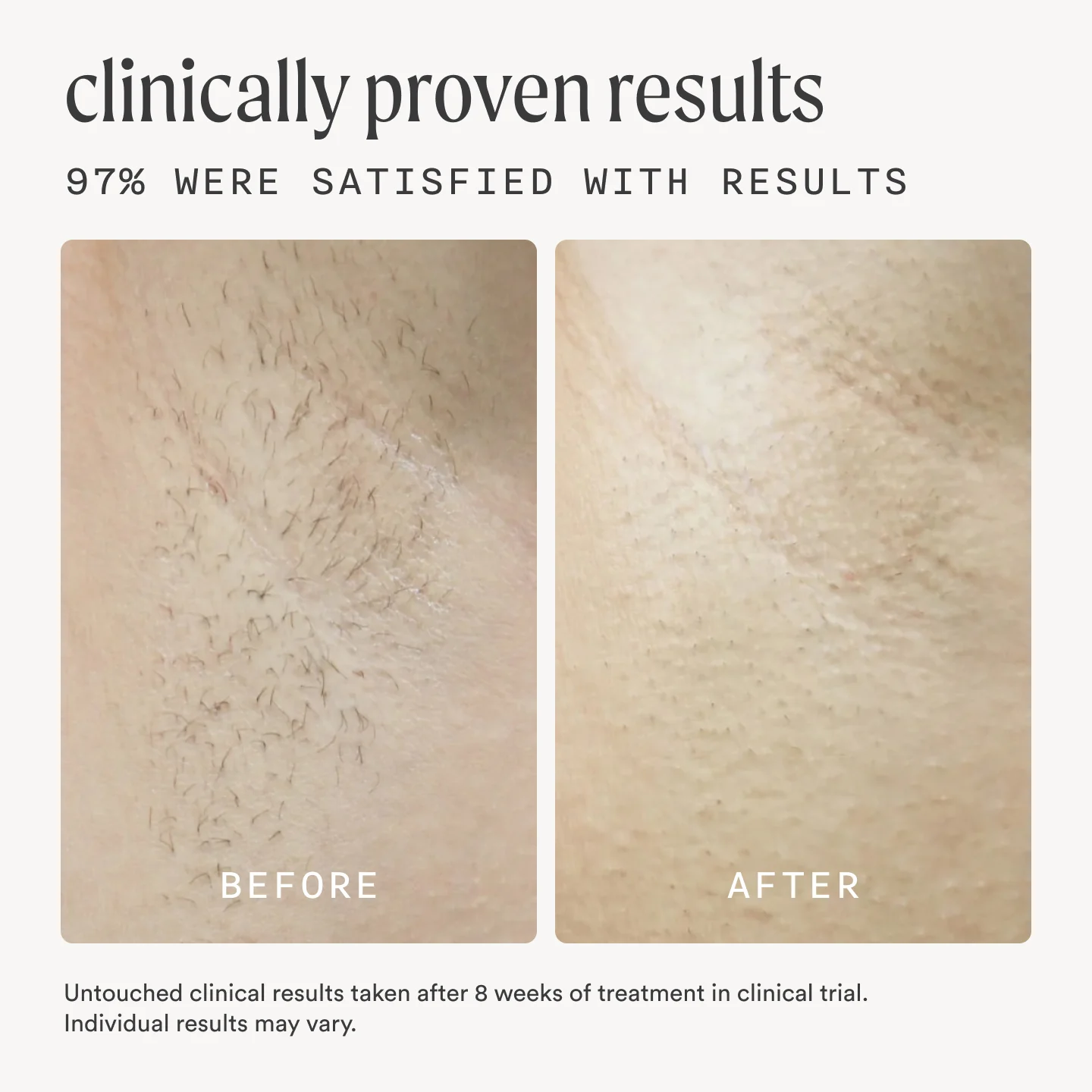 The Flasher™ 2.0 & The Nood Serum - Image 3