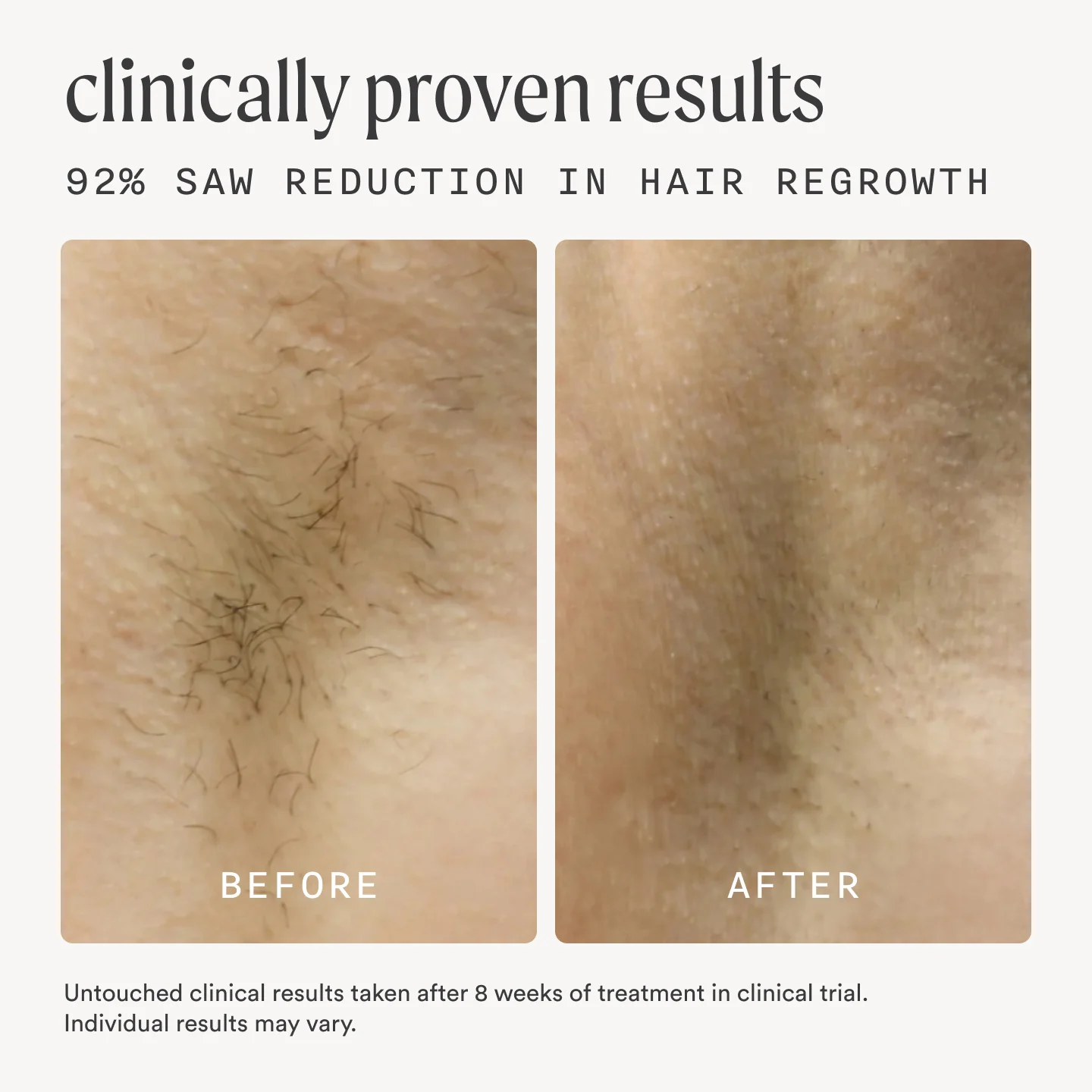 The Flasher™ 2.0 & The Nood Serum - Image 4