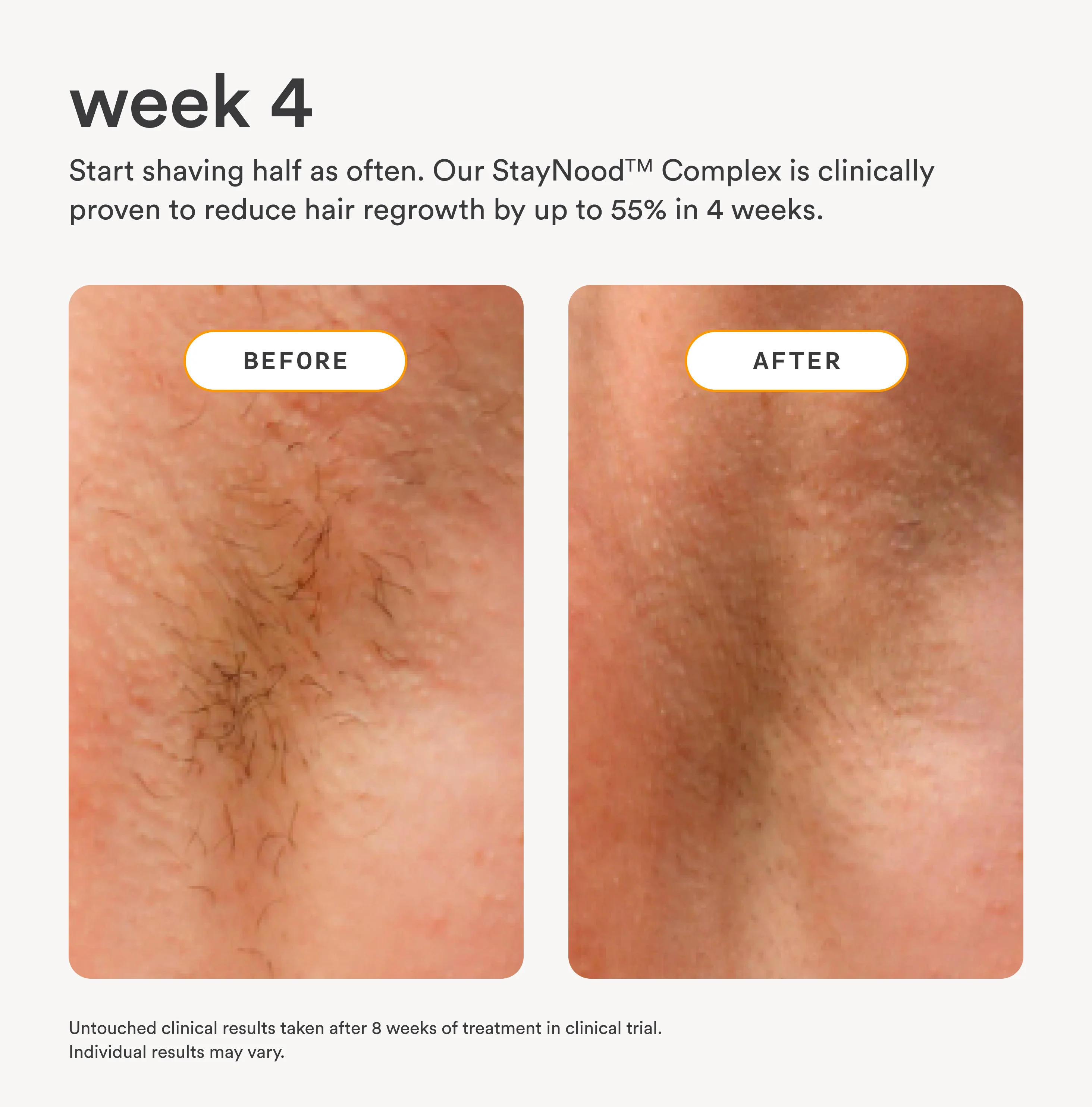 The Nood Serum - Image 3
